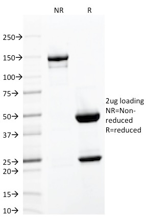 Data from SDS-PAGE analysis of Anti-CD103 antibody (Clone ITGAE/2063). Reducing lane (R) shows heavy and light chain fragments. NR lane shows intact antibody with expected MW of approximately 150 kDa. The data are consistent with a high purity, intact mAb.